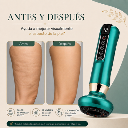 Masajeador Anticelulítico Pro con 12 Niveles de Succión